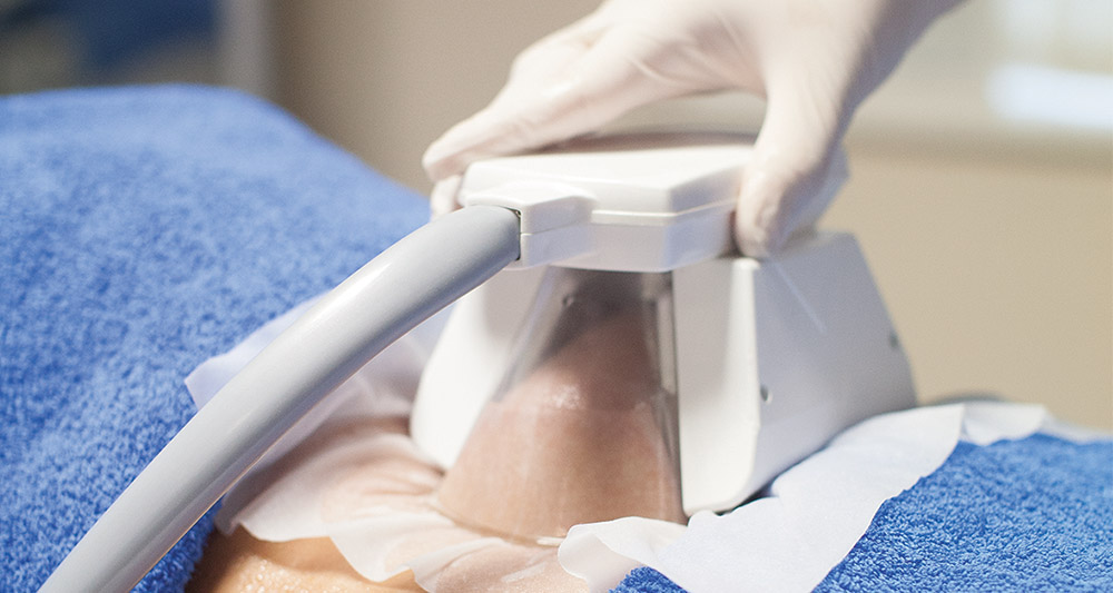 How Fat Freezing and HIFU Work Together? 2 Multiple Areas in One Session HIFU and Fat Freezing Deal