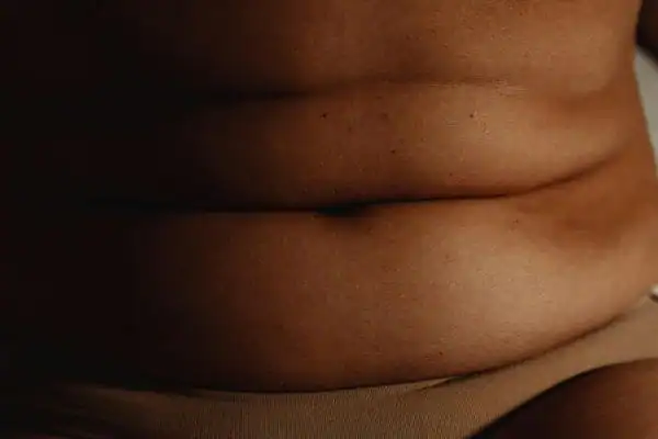 The Hidden Connection: How Stress Shapes Your Fitness and Body Composition 3 image of what stress can do on the stomach area and how Lipo 360 Deal can help to change your body shape.